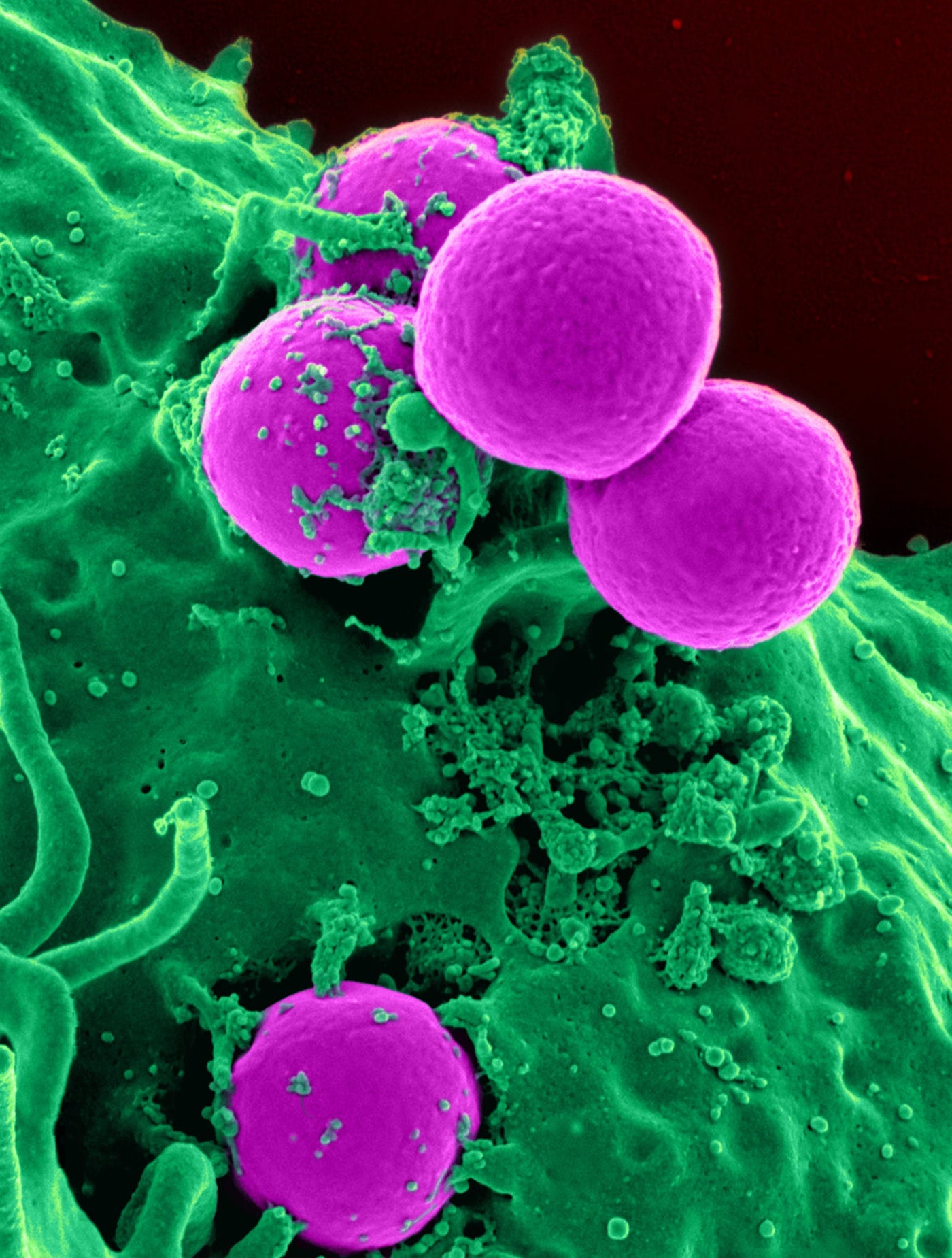 Unlocking the Power of Probiotics: A Comprehensive Review of Their Effectiveness in Managing Irritable Bowel Syndrome